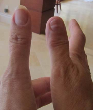 Illustration for article titled Owner Claims $225K Bentley Did This To His Wife's Thumb